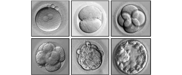 The ART of selecting the right embryo