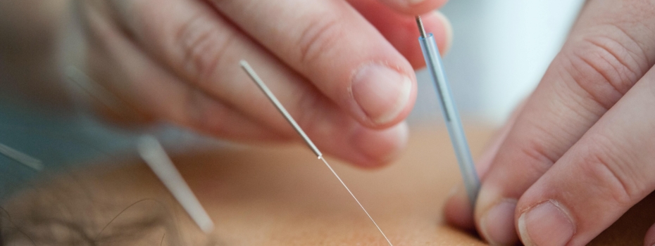 Can complementary therapies like acupuncture help conception?